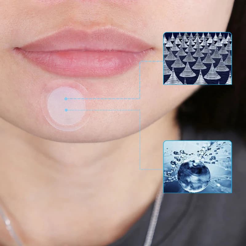 Maschera con microaghi per il contorno occhi, con acido ialuronico, cuscinetti in gel per la cura della pelle sotto gli occhi, per la rimozione delle linee sottili, lunghezza ago 0,2 mm