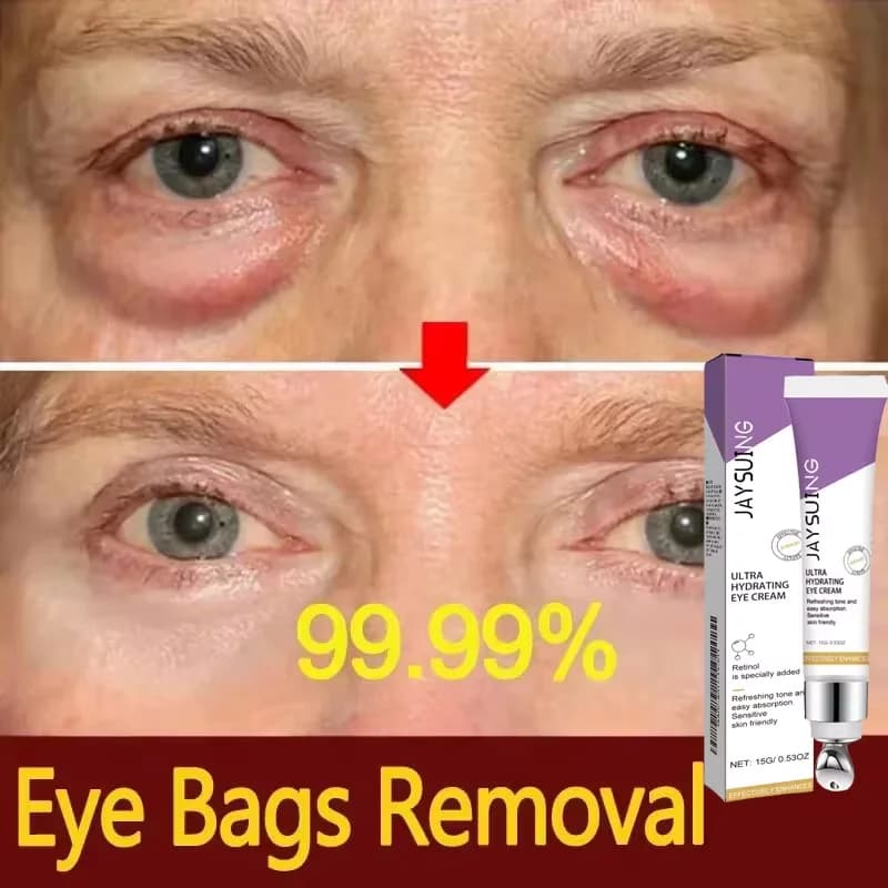 Instant Eye Bag Removal Cream Retinol Anti-Wrinkle Fade Fine Lines Anti Dark Circle Puffiness Brighten Firming Skin Eye Care