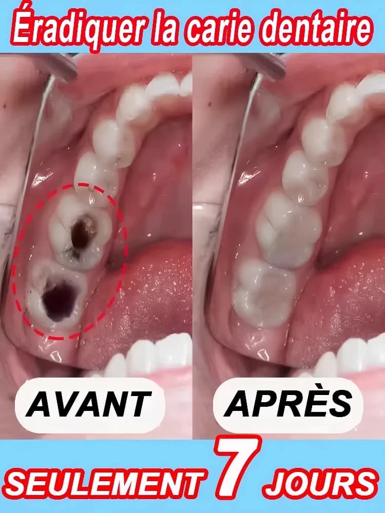 Gocce per denti di vendita calde, ripara le gengive danneggiate, allevia il dolore alle gengive, rafforzare le gengive, ripristinare le gengive sane