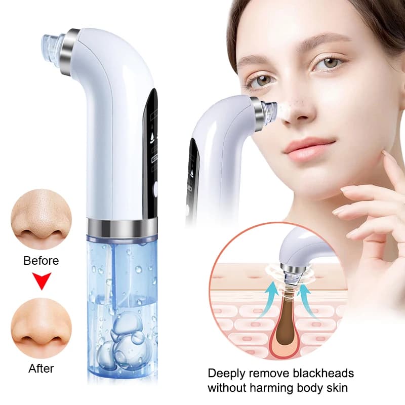 Vacuum Cleaner Black Points 2026, Electric Power Cleaner, Microbolle Face Cleaning Machine, USB Rechargeable Beauty Device