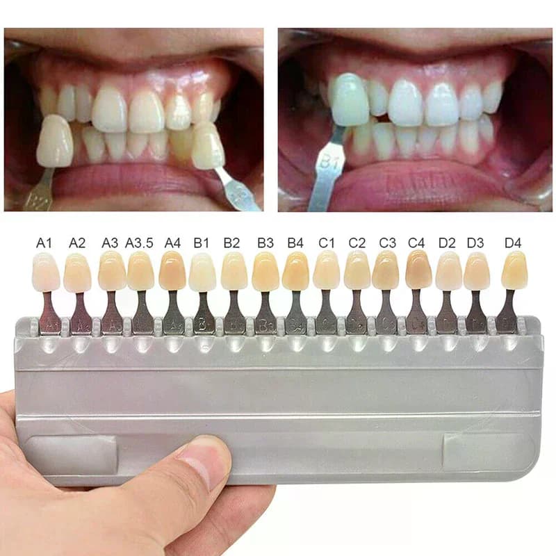 16 colori Prodotti per lo sbiancamento dei denti Prodotti per lo sbiancamento dei denti Guida Modello per denti Piastra colorimetrica Scala dei colori dentale