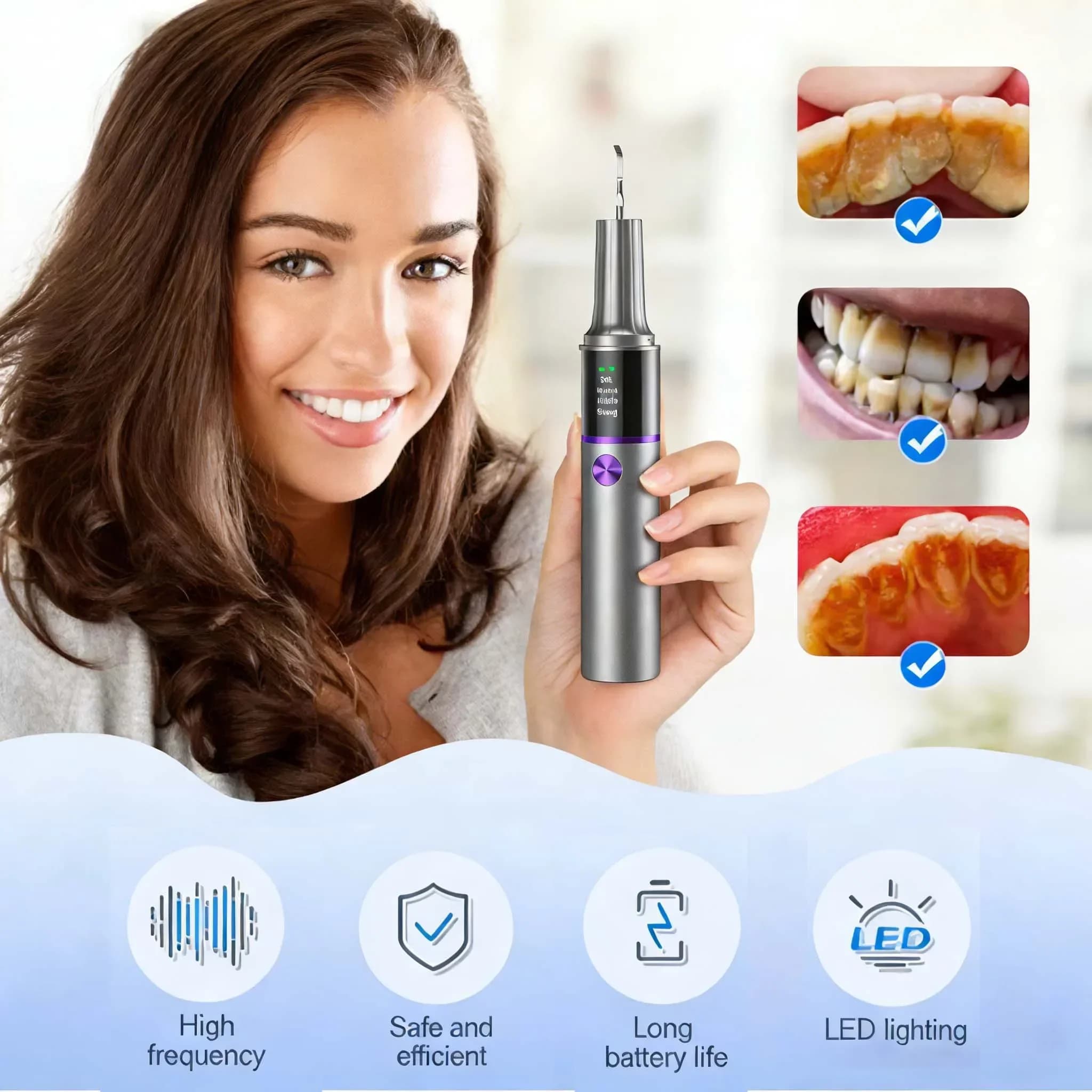 Rimuovi Tartaro Dentale a Ultrasuoni Visibile con 4 Modalità e Luce LED - Strumento Domestico per la Pulizia dei Denti e l'Igiene Orale