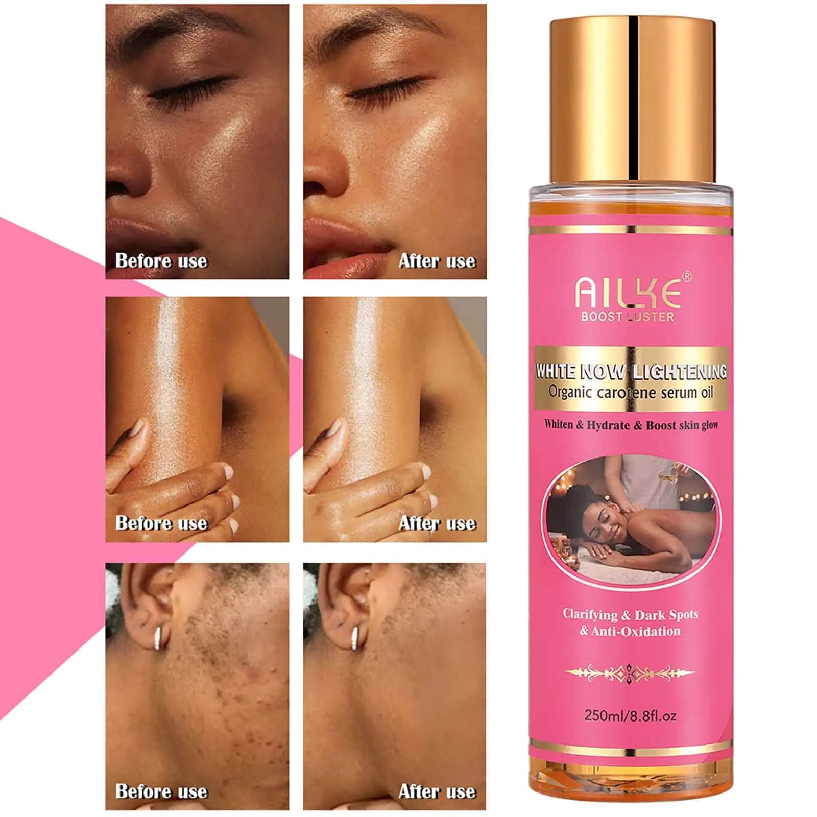 AILKE Siero di carotene biologico Olio corpo schiarente, Pelle liscia, Idratante, Con vitamina E, Olio essenziale di rosa, 250 ml/ 8,8 oz